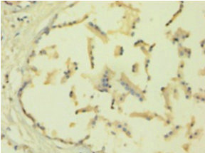 TIMP1 Antibody - Immunohistochemistry of paraffin-embedded human plastate at dilution 1:100