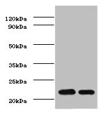 TIMP1 Antibody - Western blot All Lanes:Metalloproteinase inhibitor 1 antibody at 2ug/ml Lane 1:Jurkat whole cell lysate Lane 2:MCF-7 whole cell lysate Secondary Goat polyclonal to rabbit at 1/10000 dilution Predicted band size: 23kDa Observed band size: 23kDa