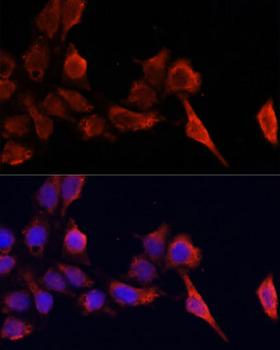 TIMP1 Antibody - Immunofluorescence analysis of HeLa cells using TIMP1 antibody at dilution of 1:100. Blue: DAPI for nuclear staining.