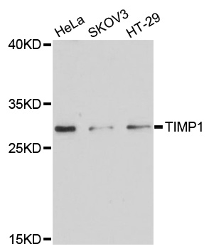TIMP1 Antibody - Western blot analysis of extracts of various cell lines, using TIMP1 antibody at 1:3000 dilution. The secondary antibody used was an HRP Goat Anti-Rabbit IgG (H+L) at 1:10000 dilution. Lysates were loaded 25ug per lane and 3% nonfat dry milk in TBST was used for blocking. An ECL Kit was used for detection and the exposure time was 90s.