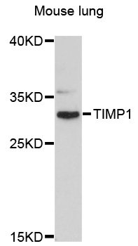 TIMP1 Antibody - Western blot analysis of extracts of mouse lung, using TIMP1 antibody at 1:3000 dilution. The secondary antibody used was an HRP Goat Anti-Rabbit IgG (H+L) at 1:10000 dilution. Lysates were loaded 25ug per lane and 3% nonfat dry milk in TBST was used for blocking. An ECL Kit was used for detection and the exposure time was 90s.