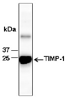 TIMP1 Antibody - Western blot analysis of recombinant human TIMP-1, using anti-TIMP-1 antibody (1 : 1,000)