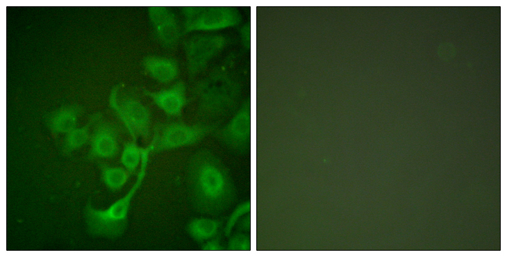 TIMP2 Antibody - Immunofluorescence analysis of A549 cells, using TIMP2 Antibody. The picture on the right is blocked with the synthesized peptide.
