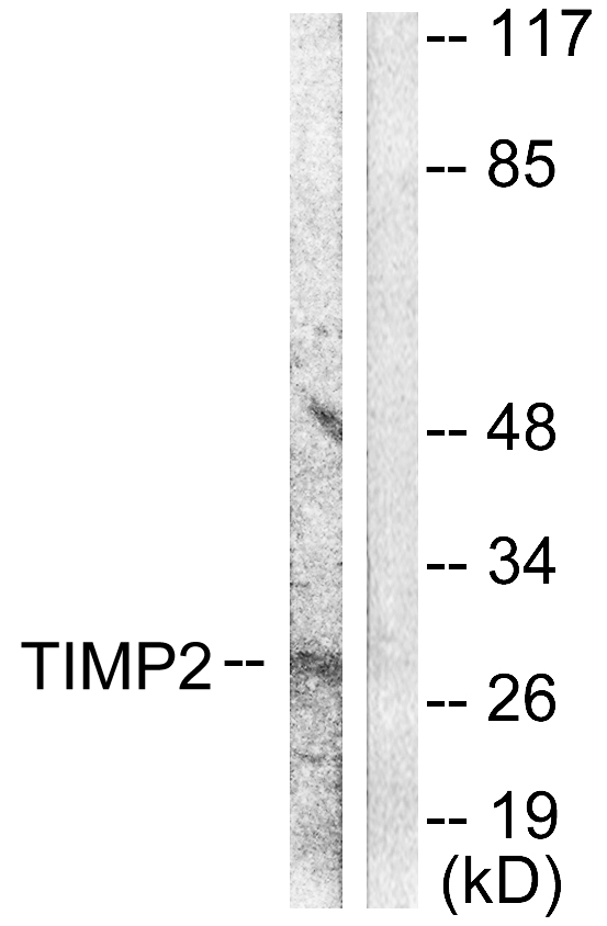 TIMP2 Antibody - Western blot analysis of lysates from A549 cells, using TIMP2 Antibody. The lane on the right is blocked with the synthesized peptide.