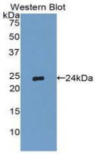 TIMP2 Antibody - Western blot of recombinant TIMP2.  This image was taken for the unconjugated form of this product. Other forms have not been tested.