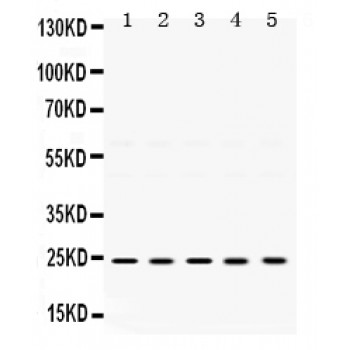 TIMP2 Antibody - TIMP2 antibody Western blot. All lanes: Anti TIMP2 at 0.5 ug/ml. Lane 1: Rat Spleen Tissue Lysate at 50 ug. Lane 2: Rat Testis Tissue Lysate at 50 ug. Lane 3: Mouse Brain Tissue Lysate at 50 ug. Lane 4: Mouse Thymus Tissue Lysate at 50 ug. Lane 5: HELA Whole Cell Lysate at 40 ug. Predicted band size: 24 kD. Observed band size: 24 kD.