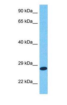 TIMP2 Antibody - Western blot of TIMP2 Antibody with human MCF7 Whole Cell lysate.  This image was taken for the unconjugated form of this product. Other forms have not been tested.