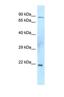TIMP2 Antibody - TIMP2 antibody Western blot of Mouse Thymus lysate. Antibody concentration 1 ug/ml.  This image was taken for the unconjugated form of this product. Other forms have not been tested.