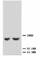 TIMP2 Antibody -  This image was taken for the unconjugated form of this product. Other forms have not been tested.