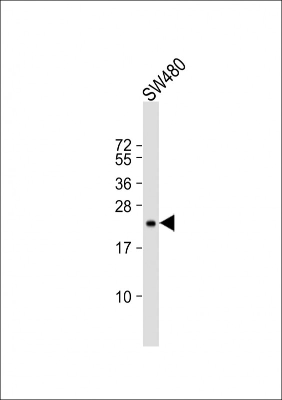 TIMP2 Antibody - Anti-TIMP2 Antibody at 1:500 dilution + SW480 whole cell lysate Lysates/proteins at 20 ug per lane. Secondary Goat Anti-mouse IgG, (H+L), Peroxidase conjugated at 1:10000 dilution. Predicted band size: 24 kDa. Blocking/Dilution buffer: 5% NFDM/TBST.