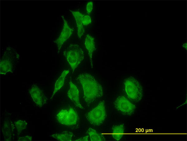 TIMP2 Antibody - Immunofluorescence of monoclonal antibody to TIMP2 on HeLa cell. [antibody concentration 10 ug/ml]