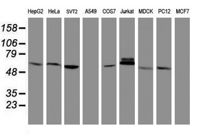 TIMP2 Antibody - Western blot of extracts (35 ug) from 9 different cell lines by using anti-TIMP2 monoclonal antibody.