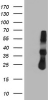 TIMP2 Antibody - HEK293T cells were transfected with the pCMV6-ENTRY control (Left lane) or pCMV6-ENTRY TIMP2 (Right lane) cDNA for 48 hrs and lysed. Equivalent amounts of cell lysates (5 ug per lane) were separated by SDS-PAGE and immunoblotted with anti-TIMP2.