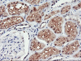 TIMP2 Antibody - IHC of paraffin-embedded Human Kidney tissue using anti-TIMP2 mouse monoclonal antibody. (Heat-induced epitope retrieval by 10mM citric buffer, pH6.0, 100C for 10min).