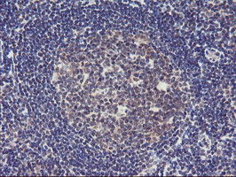TIMP2 Antibody - IHC of paraffin-embedded Human tonsil using anti-TIMP2 mouse monoclonal antibody. (Heat-induced epitope retrieval by 10mM citric buffer, pH6.0, 100C for 10min).