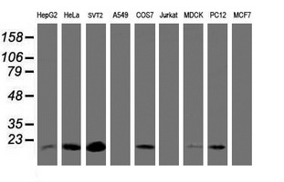 TIMP2 Antibody - Western blot of extracts (35 ug) from 9 different cell lines by using anti-TIMP2 monoclonal antibody.