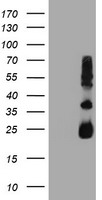 TIMP2 Antibody - HEK293T cells were transfected with the pCMV6-ENTRY control (Left lane) or pCMV6-ENTRY TIMP2 (Right lane) cDNA for 48 hrs and lysed. Equivalent amounts of cell lysates (5 ug per lane) were separated by SDS-PAGE and immunoblotted with anti-TIMP2.