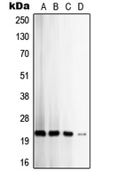 TIMP2 Antibody - Western blot analysis of TIMP2 expression in HeLa (A); SW480 (B); MCF7 (C); K562 (D) whole cell lysates.
