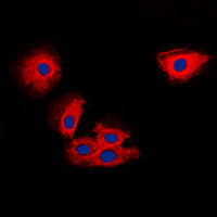 TIMP2 Antibody - Immunofluorescent analysis of TIMP2 staining in MCF7 cells. Formalin-fixed cells were permeabilized with 0.1% Triton X-100 in TBS for 5-10 minutes and blocked with 3% BSA-PBS for 30 minutes at room temperature. Cells were probed with the primary antibody in 3% BSA-PBS and incubated overnight at 4 C in a humidified chamber. Cells were washed with PBST and incubated with a DyLight 594-conjugated secondary antibody (red) in PBS at room temperature in the dark. DAPI was used to stain the cell nuclei (blue).