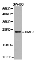 TIMP2 Antibody - Western blot of extracts of SW480 cell lines, using TIMP2 antibody.