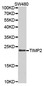 TIMP2 Antibody - Western blot analysis of extracts of SW480 cell lines.