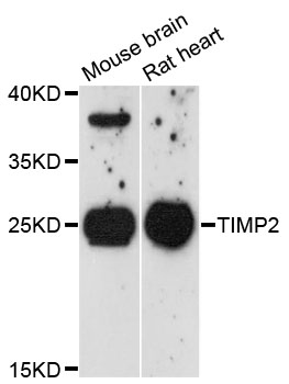 TIMP2 Antibody - Western blot analysis of extracts of various cell lines, using TIMP2 antibody at 1:3000 dilution. The secondary antibody used was an HRP Goat Anti-Rabbit IgG (H+L) at 1:10000 dilution. Lysates were loaded 25ug per lane and 3% nonfat dry milk in TBST was used for blocking. An ECL Kit was used for detection and the exposure time was 90s.
