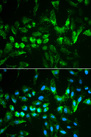 TIMP2 Antibody - Immunofluorescence analysis of MCF-7 cells using TIMP2 antibody. Blue: DAPI for nuclear staining.