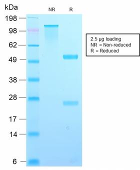 TIMP2 Antibody - SDS-PAGE Analysis Purified TIMP2 Rabbit Recombinant Monoclonal Antibody (TIMP2/2488R). Confirmation of Purity and Integrity of Antibody.