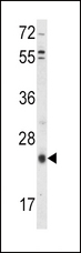 TIMP3 Antibody - Western blot of TIMP3 Antibody in HepG2 cell line lysates (35 ug/lane). TIMP3 (arrow) was detected using the purified antibody.
