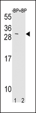 TIMP3 Antibody - Western blot of TIMP3 Antibody antibody pre-incubated without(lane 1) and with(lane 2) blocking peptide in mouse NIH-3T3 cell line lysate. TIMP3 Antibody (arrow) was detected using the purified antibody.