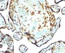 TIMP3 Antibody - TIMP3 antibody immunohistochemistry placenta.  This image was taken for the unmodified form of this product. Other forms have not been tested.