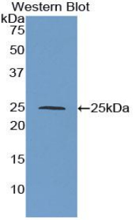 TIMP3 Antibody - Western blot of recombinant TIMP3.  This image was taken for the unconjugated form of this product. Other forms have not been tested.