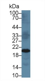 TIMP3 Antibody - Western Blot; Sample: Mouse Kidney lysate; Primary Ab: 5µg/ml Rabbit Anti-Human TIMP3 Antibody Second Ab: 0.2µg/mL HRP-Linked Caprine Anti-Rabbit IgG Polyclonal Antibody