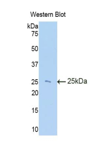 TIMP3 Antibody - Western blot of recombinant TIMP3.  This image was taken for the unconjugated form of this product. Other forms have not been tested.