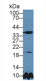 TIMP3 Antibody - Western Blot; Sample: Rat Cerebrum lysate; Primary Ab: 5µg/ml Rabbit Anti-Rat TIMP3 Antibody Second Ab: 0.2µg/mL HRP-Linked Caprine Anti-Rabbit IgG Polyclonal Antibody