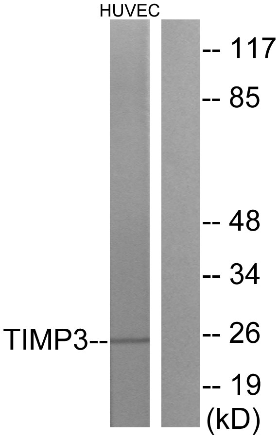 TIMP3 Antibody - Western blot analysis of lysates from HUVEC cells, using TIMP3 Antibody. The lane on the right is blocked with the synthesized peptide.