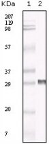 TIMP3 Antibody - Western blot of anti- TIMP3 polyclonal antibody against truncated TIMP3 recombinant protein.