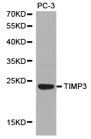 TIMP3 Antibody - Western blot of extracts of PC-3 cell lines, using TIMP3 antibody.