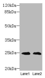 TIMP3 Antibody - Western blot All lanes: Metalloproteinase inhibitor 3 antibody at 2µg/ml Lane 1: EC109 whole cell lysate Lane 2: 293T whole cell lysate Secondary Goat polyclonal to rabbit IgG at 1/10000 dilution Predicted band size: 24 kDa Observed band size: 24 kDa