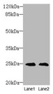 TIMP3 Antibody - Western blot All lanes: Metalloproteinase inhibitor 3 antibody at 2µg/ml Lane 1: EC109 whole cell lysate Lane 2: 293T whole cell lysate Secondary Goat polyclonal to rabbit IgG at 1/10000 dilution Predicted band size: 24 kDa Observed band size: 24 kDa