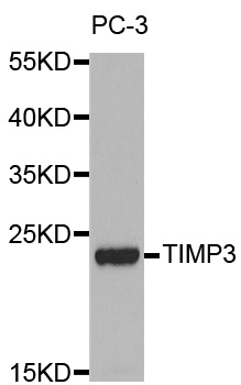 TIMP3 Antibody - Western blot analysis of extracts of PC-3 cell lines, using TIMP3 antibody.