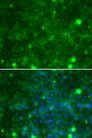 TIMP3 Antibody - Immunofluorescence analysis of MCF-7 cells using TIMP3 antibody. Blue: DAPI for nuclear staining.