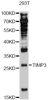TIMP3 Antibody - Western blot analysis of extracts of 293T cells, using TIMP3 antibody at 1:3000 dilution. The secondary antibody used was an HRP Goat Anti-Rabbit IgG (H+L) at 1:10000 dilution. Lysates were loaded 25ug per lane and 3% nonfat dry milk in TBST was used for blocking. An ECL Kit was used for detection and the exposure time was 60s.
