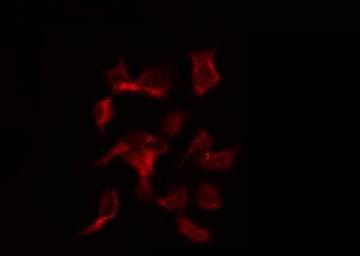 TIMP3 Antibody - Staining HuvEc cells by IF/ICC. The samples were fixed with PFA and permeabilized in 0.1% Triton X-100, then blocked in 10% serum for 45 min at 25°C. The primary antibody was diluted at 1:200 and incubated with the sample for 1 hour at 37°C. An Alexa Fluor 594 conjugated goat anti-rabbit IgG (H+L) Ab, diluted at 1/600, was used as the secondary antibody.