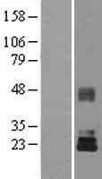 TIMP3 Protein - Western validation with an anti-DDK antibody * L: Control HEK293 lysate R: Over-expression lysate