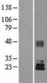 TIMP3 Protein - Western validation with an anti-DDK antibody * L: Control HEK293 lysate R: Over-expression lysate