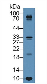 TIMP4 Antibody - Western Blot; Sample: Human BXPC3 cell lysate; Primary Ab: 5µg/ml Rabbit Anti-Porcine TIMP4 Antibody Second Ab: 0.2µg/mL HRP-Linked Caprine Anti-Rabbit IgG Polyclonal Antibody