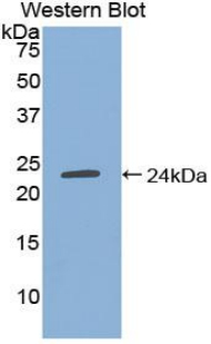 TIMP4 Antibody - Western blot of recombinant TIMP4.  This image was taken for the unconjugated form of this product. Other forms have not been tested.