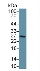 TIMP4 Antibody - Western Blot; Sample: Rat Fetal rat lysate; Primary Ab: 1µg/ml Rabbit Anti-Human TIMP4 Antibody Second Ab: 0.2µg/mL HRP-Linked Caprine Anti-Rabbit IgG Polyclonal Antibody