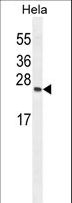 TIMP4 Antibody - TIMP4 Antibody western blot of HeLa cell line lysates (35 ug/lane). The TIMP4 antibody detected the TIMP4 protein (arrow).